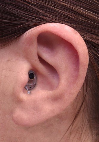 Oreille avec ALVIS ALD410 intras Oreille avec ALVIS ALD410 intras